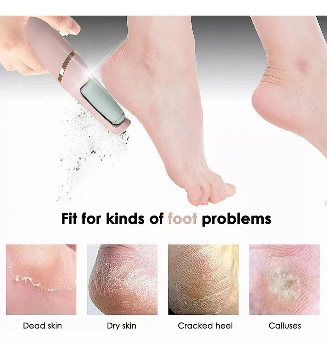 SuaviFeet – Lima Eléctrica Profesional con Tecnología que elimina callos y deja tus pies increíblemente suaves.👣✨